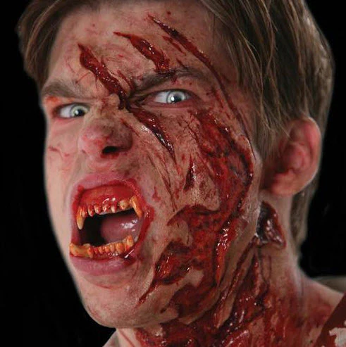 Teeth FX - Image 2